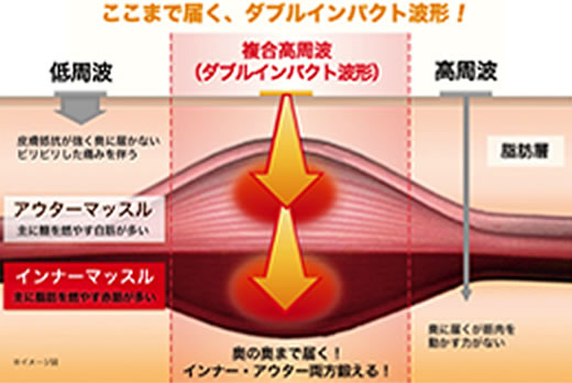 楽トレEMS
